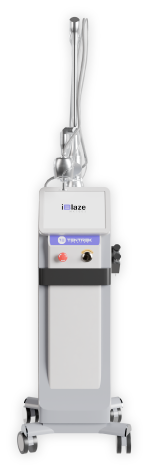 iBlaze